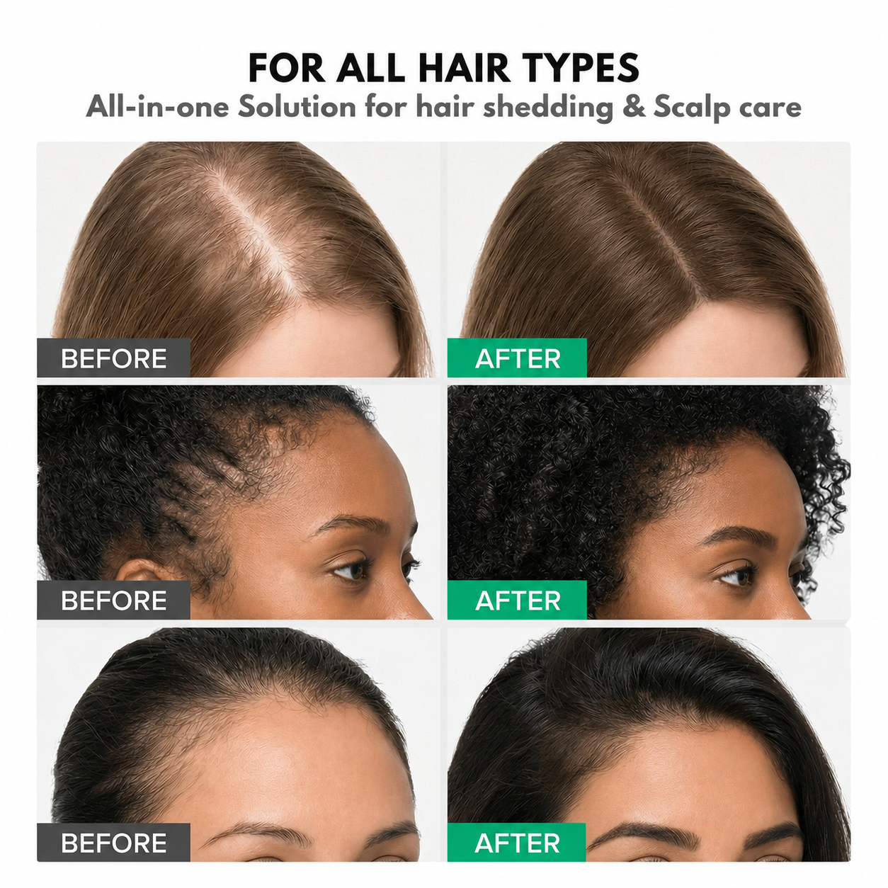 Korean Hair Growth Serum