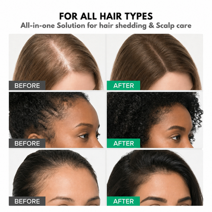 Korean Hair Growth Serum